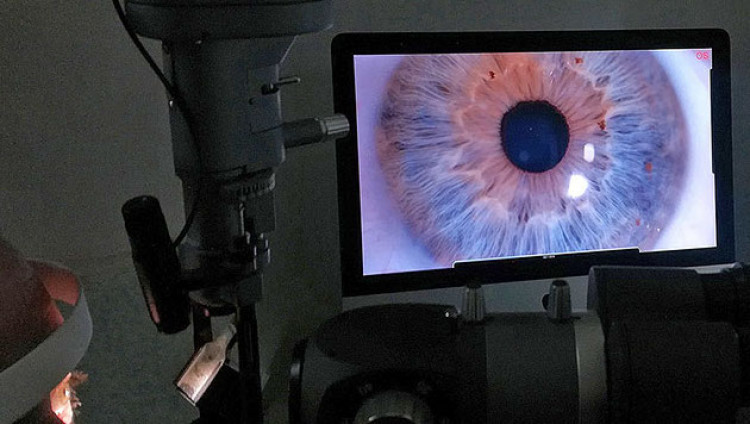 Израильский стартап получил одобрение FDA на методику лечения глаукомы лазером