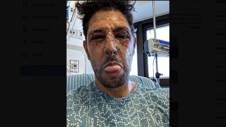 Актер «Фауды» Идан Амеди впервые опубликовал фото вскоре после ранения в Газе