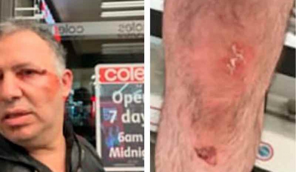 В Мельбурне двух евреев избили в супермаркете на почве антисемитизма