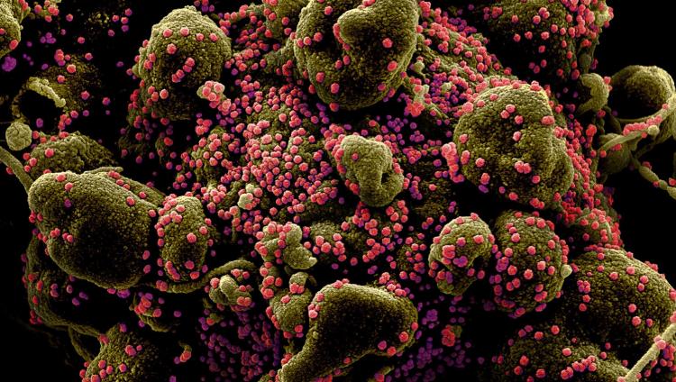 Ученые Израиля рассчитали массу всех частиц коронавируса SARS-CoV-2 в мире