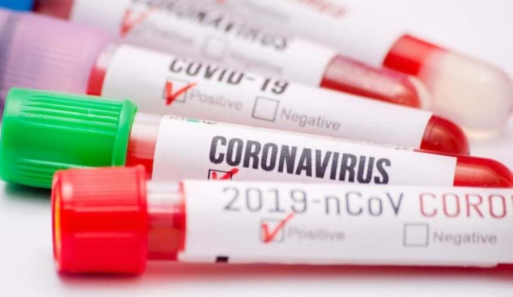Медики из Израиля предложили удобный тест на коронавирус