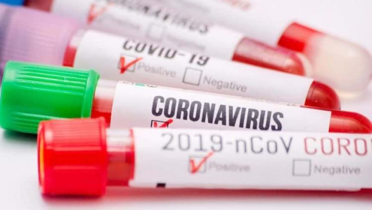 Медики из Израиля предложили удобный тест на коронавирус