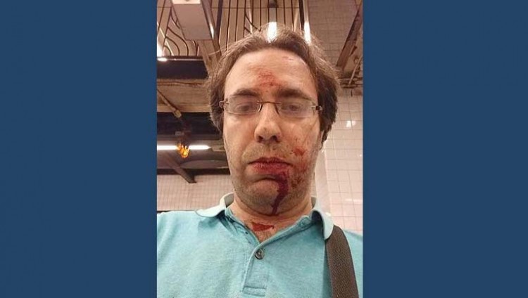 В метро Нью-Йорка жестоко избили пассажира-еврея