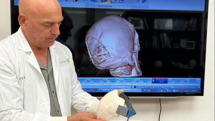 Израильские врачи напечатали на 3D-принтере «заплатку» для черепа мужчины, пострадавшего в теракте