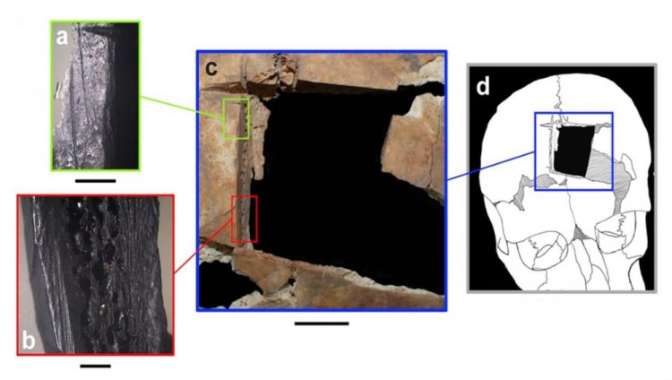 Археологи обнаружили в Израиле свидетельства операции на мозге, проведенной 3,5 тыс. лет назад 