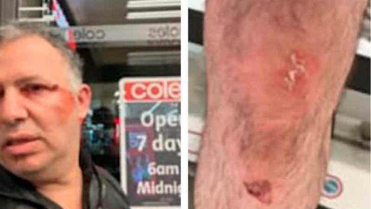 В Мельбурне двух евреев избили в супермаркете на почве антисемитизма