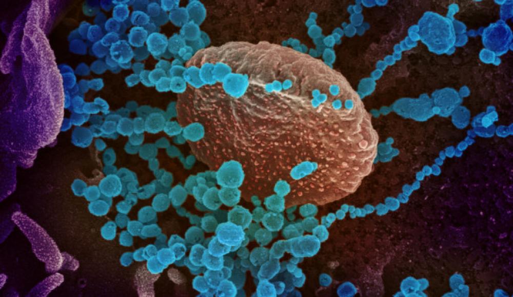 Израильские ученые научились уничтожать коронавирус за 2 секунды с помощью миллиметровых радиоволн