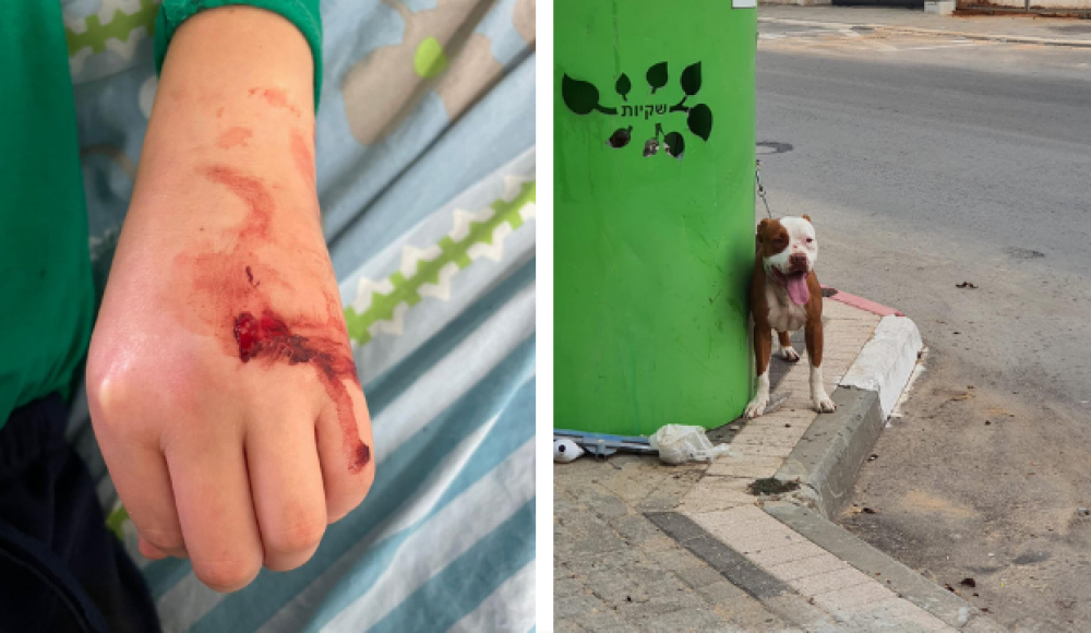 10-летний израильтянин защитил маленьких собачек от стаффордширского терьера собственным телом