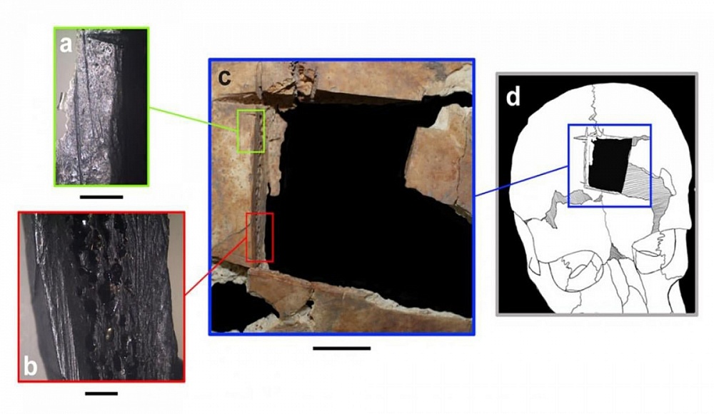 Археологи обнаружили в Израиле свидетельства операции на мозге, проведенной 3,5 тыс. лет назад 