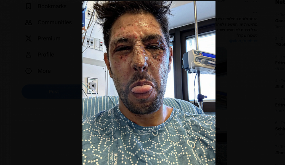 Актер «Фауды» Идан Амеди впервые опубликовал фото вскоре после ранения в Газе